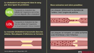 Quel est le pire aliment pour le cholestérol ?