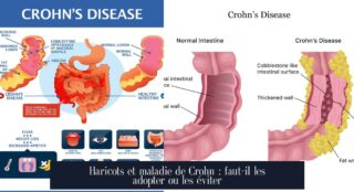 Haricots et maladie de Crohn : faut-il les adopter ou les éviter