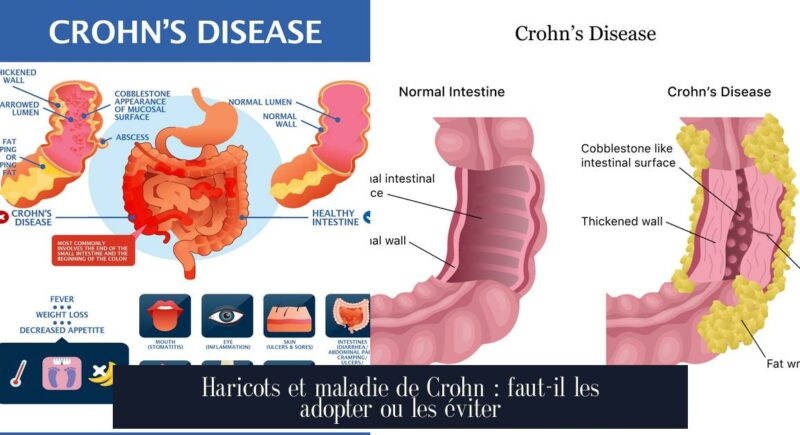Haricots et maladie de Crohn : faut-il les adopter ou les éviter