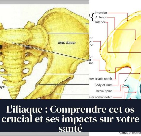 L'iliaque : Comprendre cet os crucial et ses impacts sur votre santé