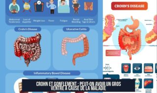 Crohn et Gonflement : Peut-on avoir un Gros Ventre à Cause de la Maladie