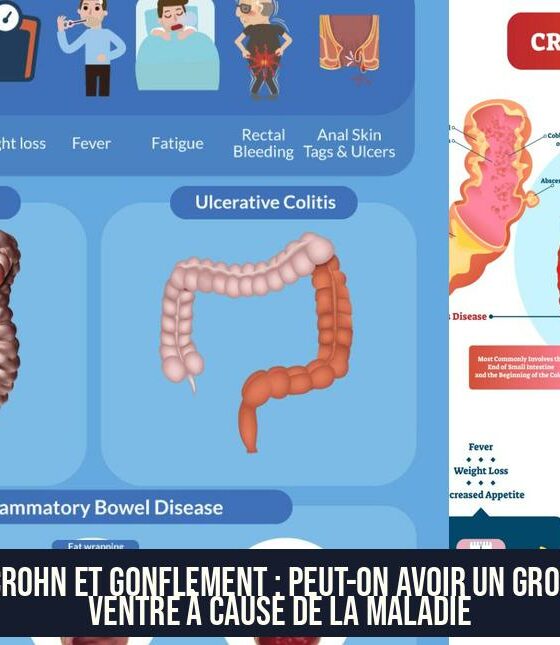 Crohn et Gonflement : Peut-on avoir un Gros Ventre à Cause de la Maladie