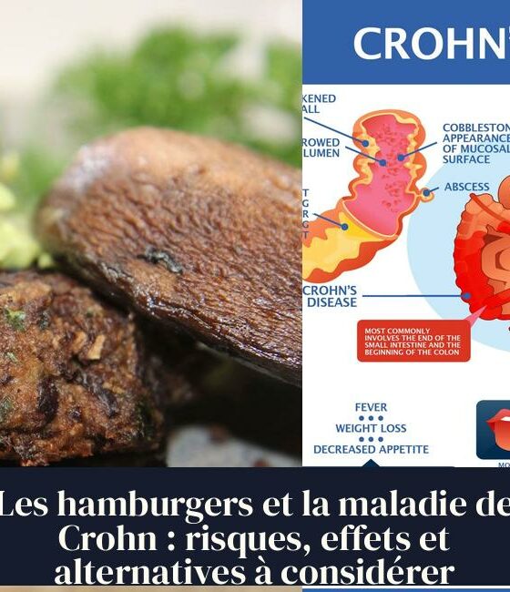 Les hamburgers et la maladie de Crohn : risques, effets et alternatives à considérer