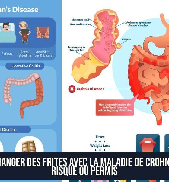 Manger des frites avec la maladie de Crohn : risqué ou permis