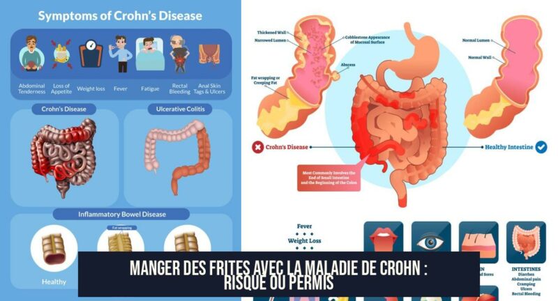 Manger des frites avec la maladie de Crohn : risqué ou permis