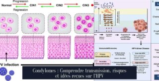 Condylomes : Comprendre transmission, risques et idées reçues sur l'HPV