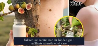 Enlever une verrue avec du lait de figue : méthode naturelle et efficace