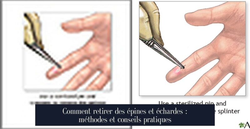 Comment retirer des épines et échardes : méthodes et conseils pratiques