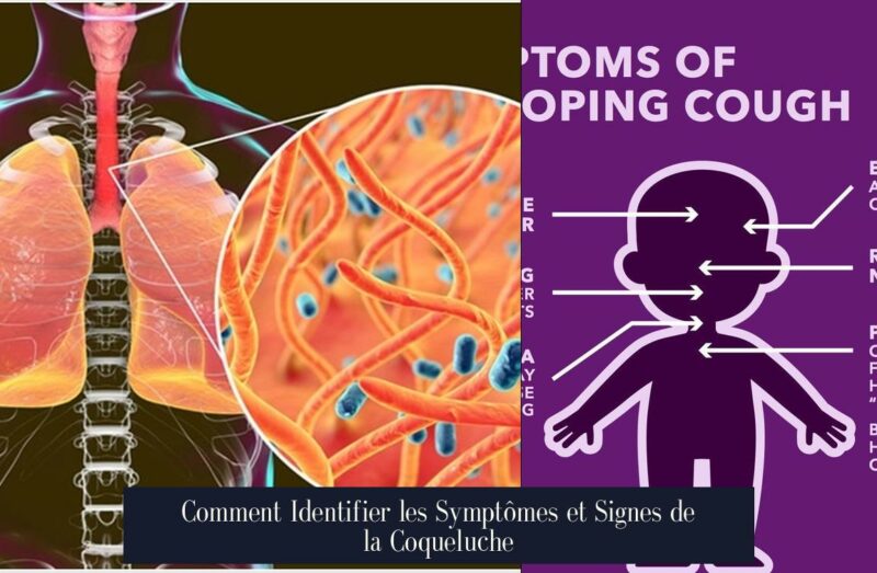 Comment Identifier les Symptômes et Signes de la Coqueluche