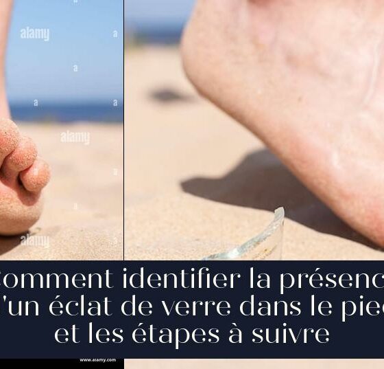 Comment identifier la présence d'un éclat de verre dans le pied et les étapes à suivre