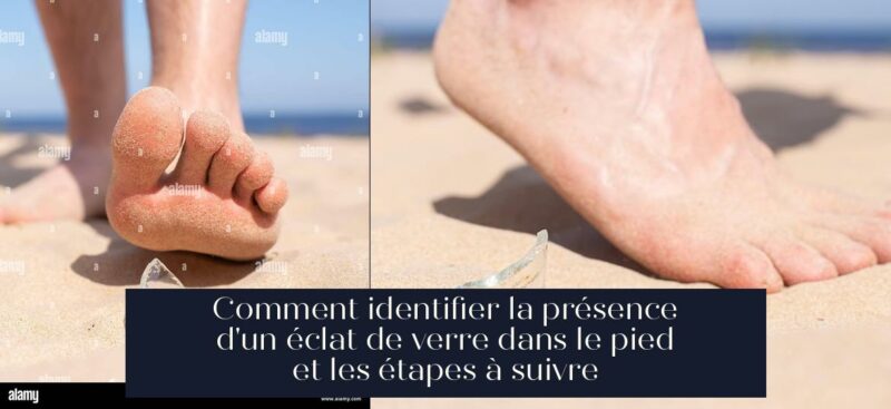 Comment identifier la présence d'un éclat de verre dans le pied et les étapes à suivre
