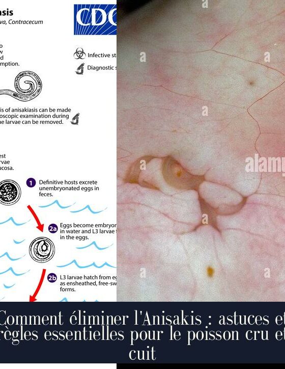 Comment éliminer l'Anisakis : astuces et règles essentielles pour le poisson cru et cuit