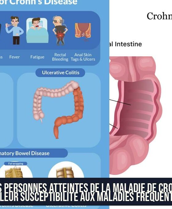 Les personnes atteintes de la maladie de Crohn et leur susceptibilité aux maladies fréquentes