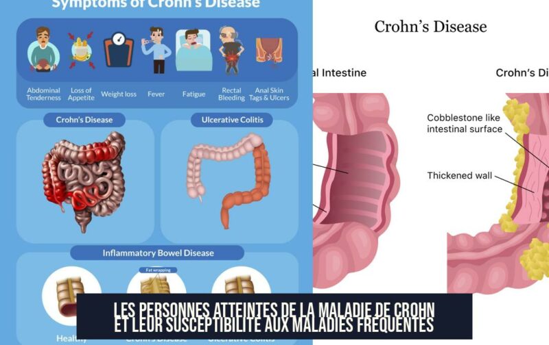 Les personnes atteintes de la maladie de Crohn et leur susceptibilité aux maladies fréquentes