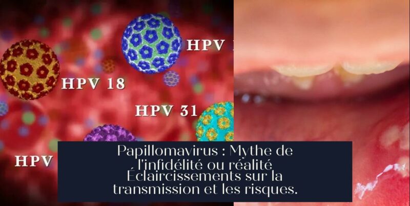 Papillomavirus : Mythe de l'infidélité ou réalité Éclaircissements sur la transmission et les risques.