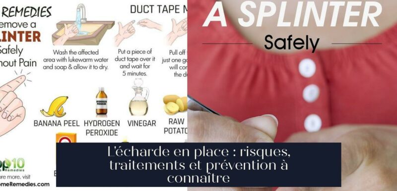 L'écharde en place : risques, traitements et prévention à connaître