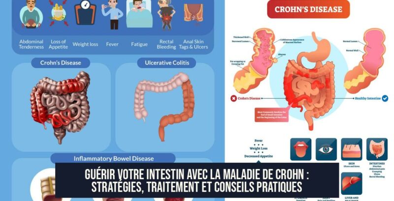 Guérir votre intestin avec la maladie de Crohn : stratégies, traitement et conseils pratiques