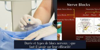 Durée et types de blocs nerveux : que faut-il savoir sur leur efficacité