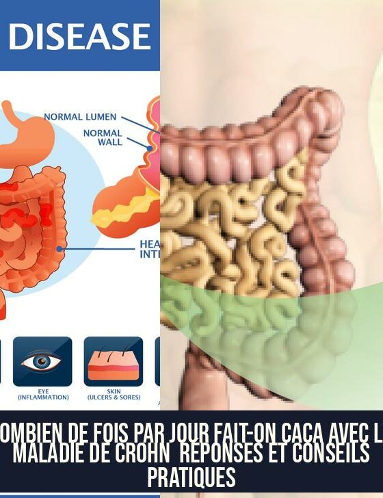 Combien de fois par jour fait-on caca avec la maladie de Crohn Réponses et conseils pratiques
