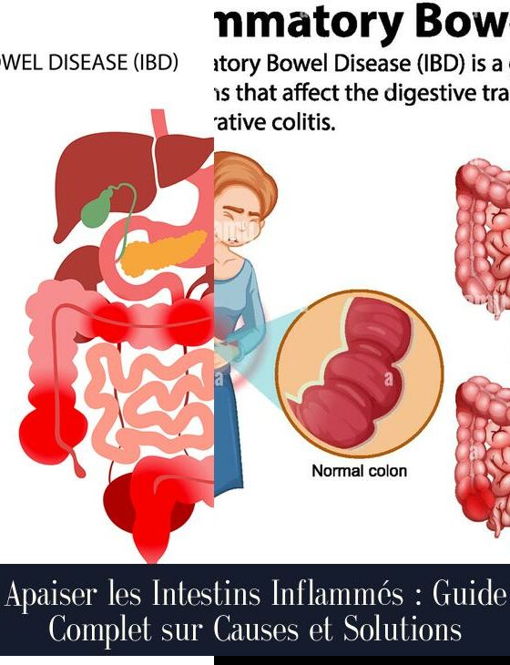 Apaiser les Intestins Inflammés : Guide Complet sur Causes et Solutions