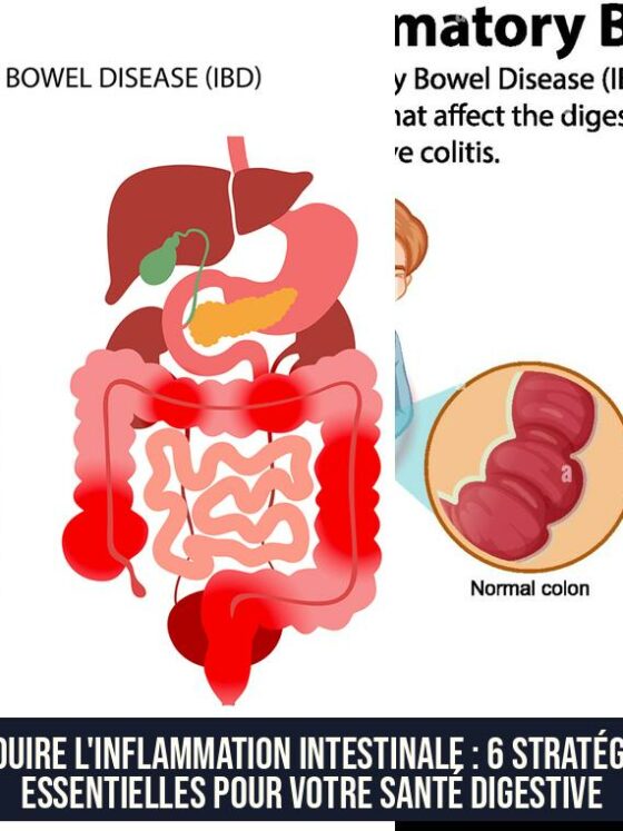 Réduire l'inflammation intestinale : 6 stratégies essentielles pour votre santé digestive