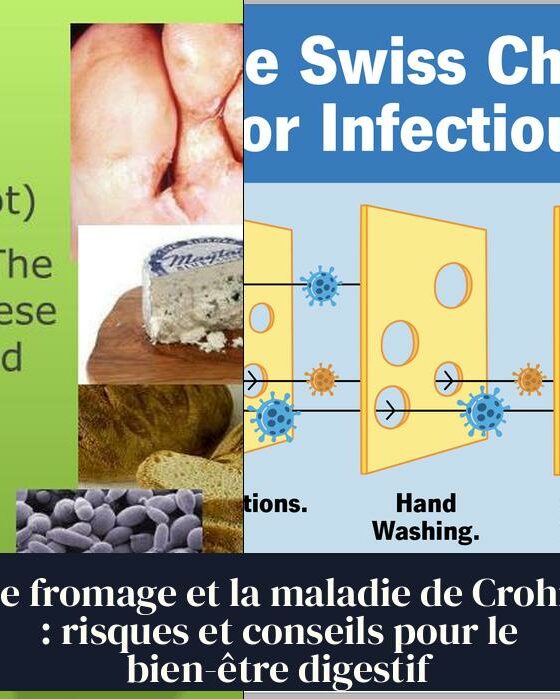 Le fromage et la maladie de Crohn : risques et conseils pour le bien-être digestif