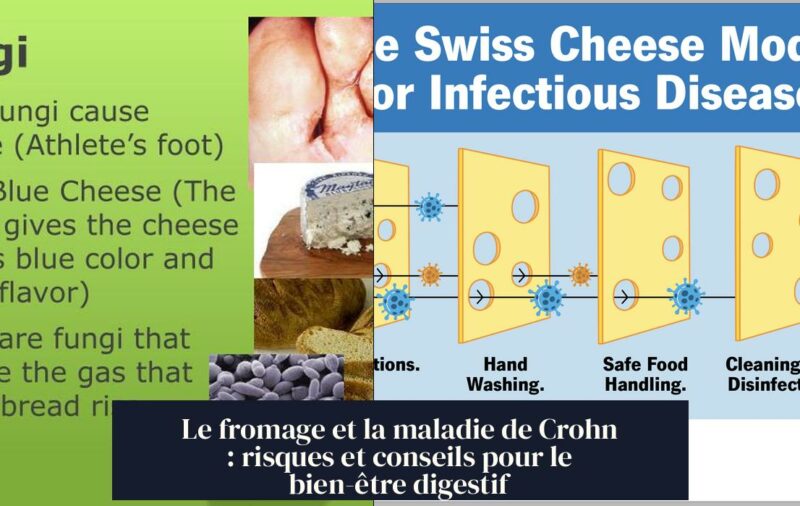 Le fromage et la maladie de Crohn : risques et conseils pour le bien-être digestif