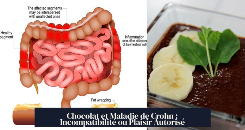 Chocolat et Maladie de Crohn : Incompatibilité ou Plaisir Autorisé
