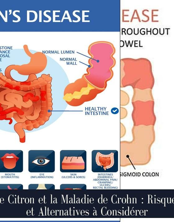 Le Citron et la Maladie de Crohn : Risques et Alternatives à Considérer