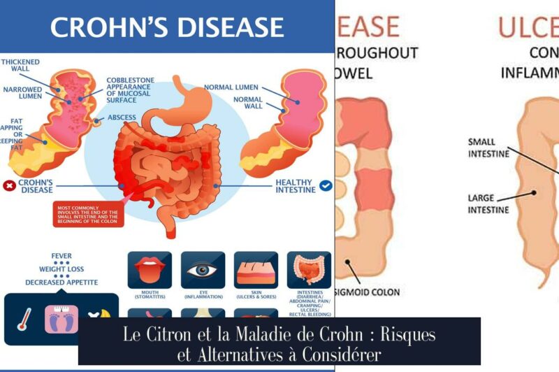 Le Citron et la Maladie de Crohn : Risques et Alternatives à Considérer