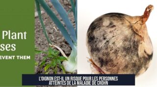L'oignon est-il un risque pour les personnes atteintes de la maladie de Crohn