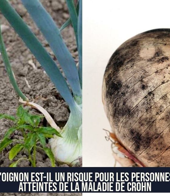 L'oignon est-il un risque pour les personnes atteintes de la maladie de Crohn