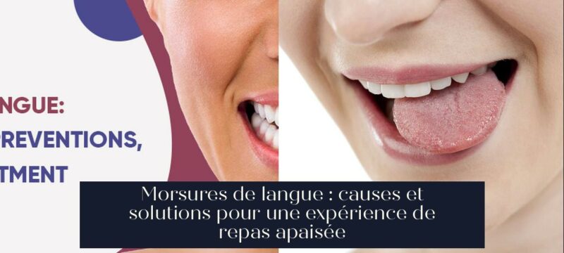 Morsures de langue : causes et solutions pour une expérience de repas apaisée