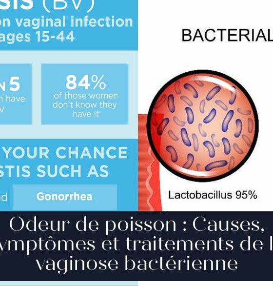 Odeur de poisson : Causes, symptômes et traitements de la vaginose bactérienne