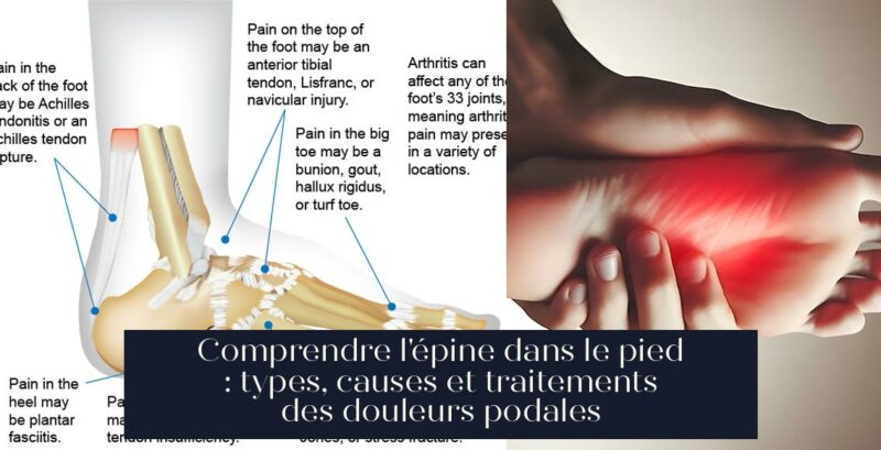 Comprendre l'épine dans le pied : types, causes et traitements des douleurs podales