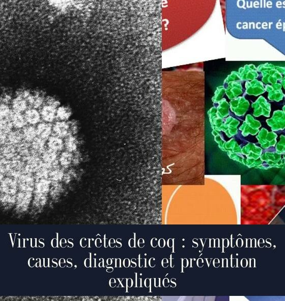 Virus des crêtes de coq : symptômes, causes, diagnostic et prévention expliqués