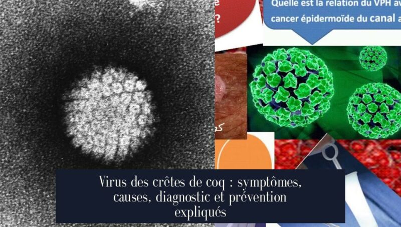 Virus des crêtes de coq : symptômes, causes, diagnostic et prévention expliqués