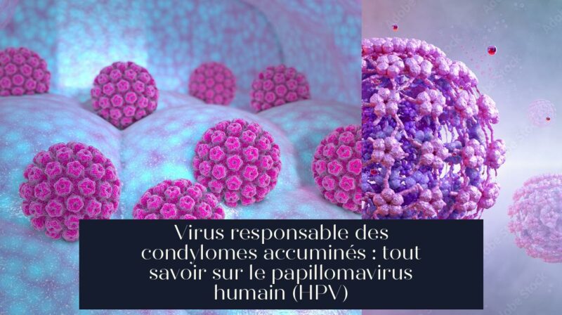 Virus responsable des condylomes accuminés : tout savoir sur le papillomavirus humain (HPV)