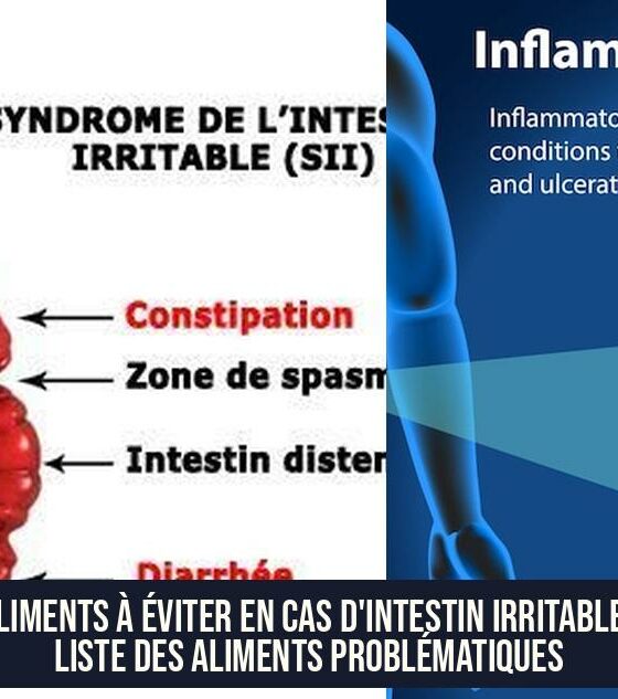 Aliments à éviter en cas d'intestin irritable : liste des aliments problématiques