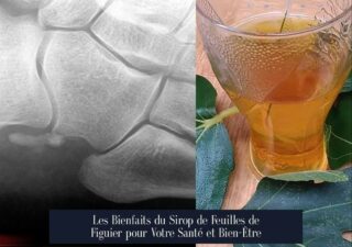 Les Bienfaits du Sirop de Feuilles de Figuier pour Votre Santé et Bien-Être