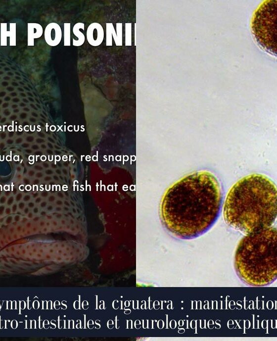Symptômes de la ciguatera : manifestations gastro-intestinales et neurologiques expliquées