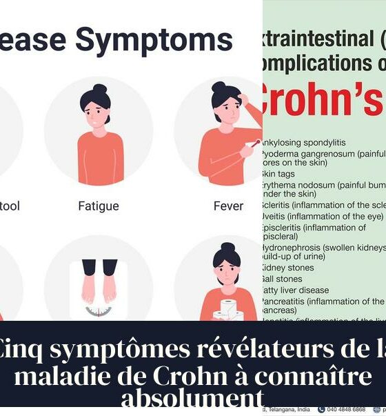 Cinq symptômes révélateurs de la maladie de Crohn à connaître absolument