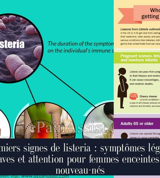 Premiers signes de listeria : symptômes légers, graves et attention pour femmes enceintes et nouveau-nés