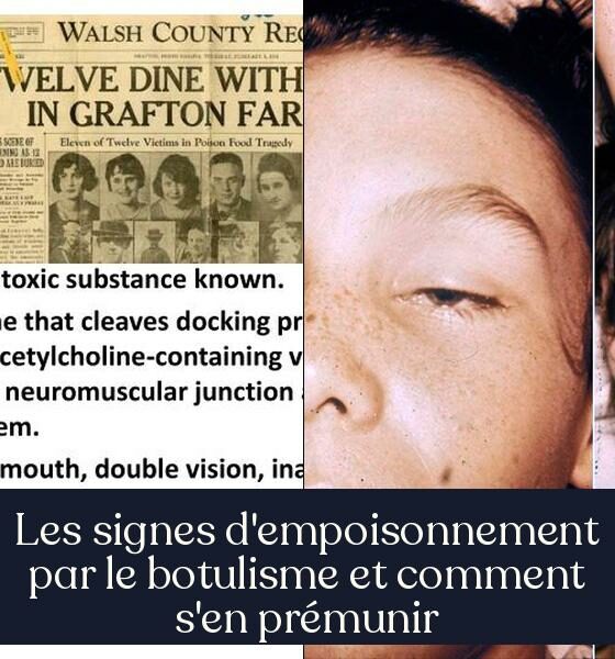 Les signes d'empoisonnement par le botulisme et comment s'en prémunir