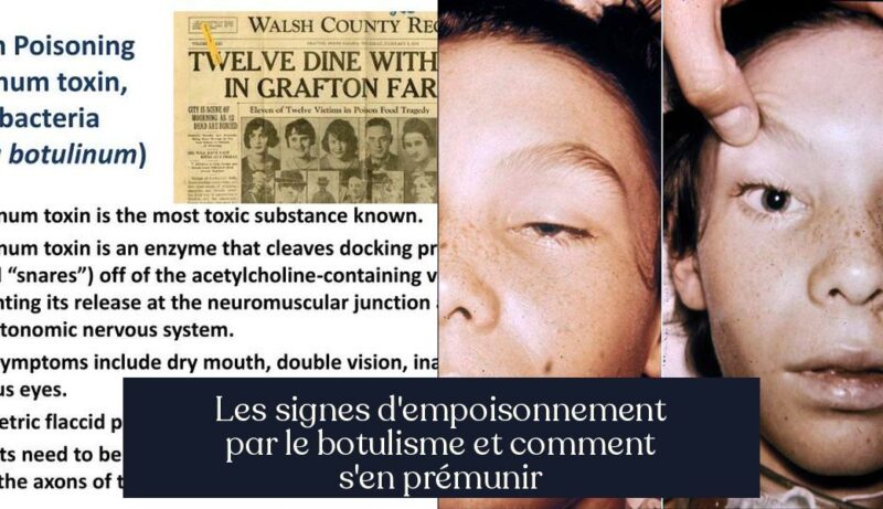 Les signes d'empoisonnement par le botulisme et comment s'en prémunir