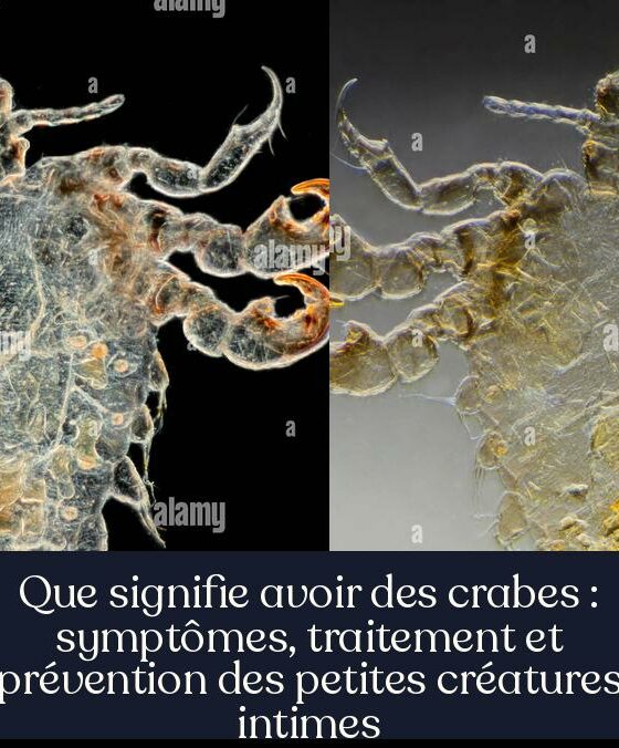 Que signifie avoir des crabes : symptômes, traitement et prévention des petites créatures intimes