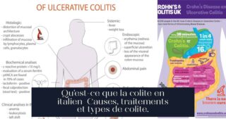 Qu'est-ce que la colite en italien Causes, traitements et types de colite.