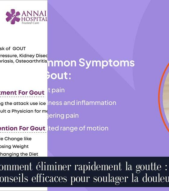 Comment éliminer rapidement la goutte : 7 conseils efficaces pour soulager la douleur