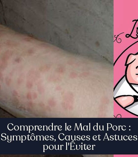 Comprendre le Mal du Porc : Symptômes, Causes et Astuces pour l'Éviter
