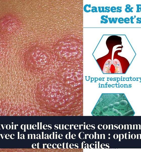 Savoir quelles sucreries consommer avec la maladie de Crohn : options et recettes faciles